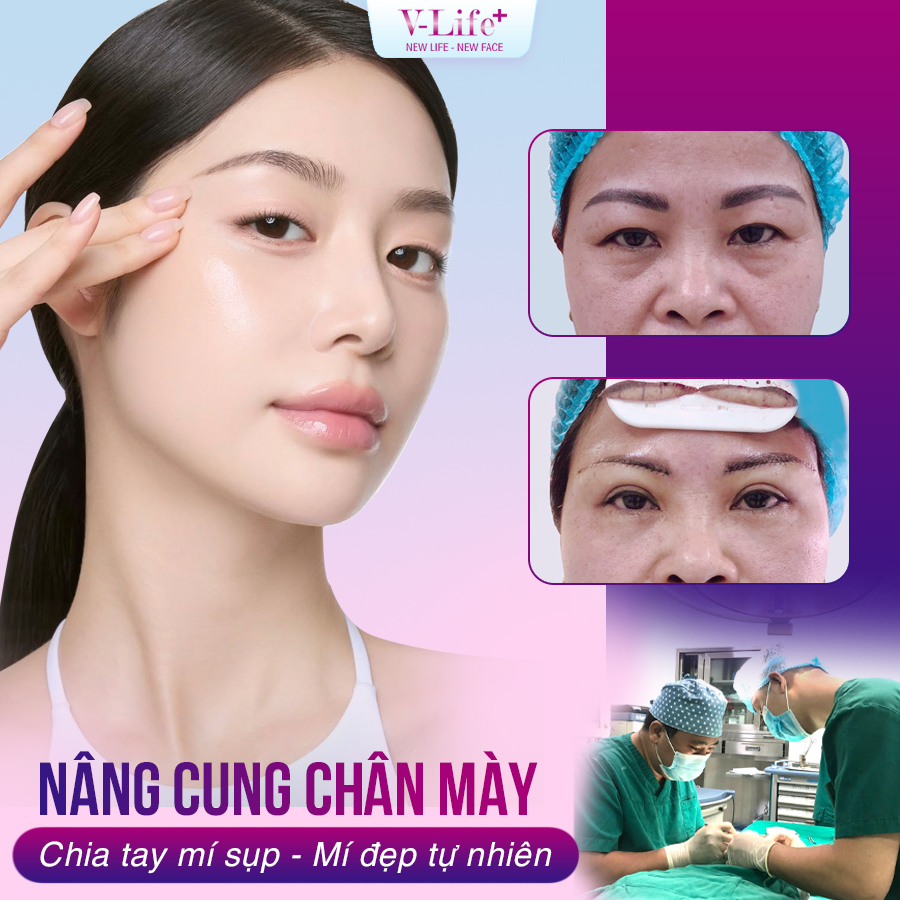 Treo chân mày trực tiếp, có treo cân