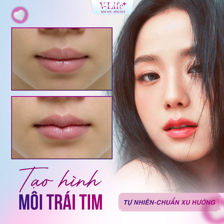 Cắt môi trái tim