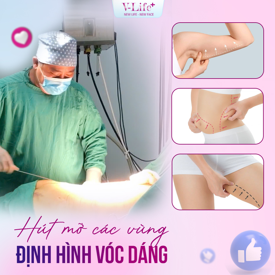 Hút mỡ vùng khác trên cơ thể