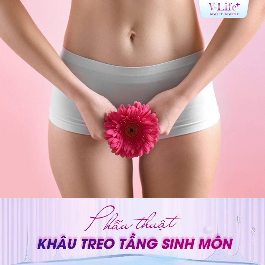 Khâu treo tầng sinh môn