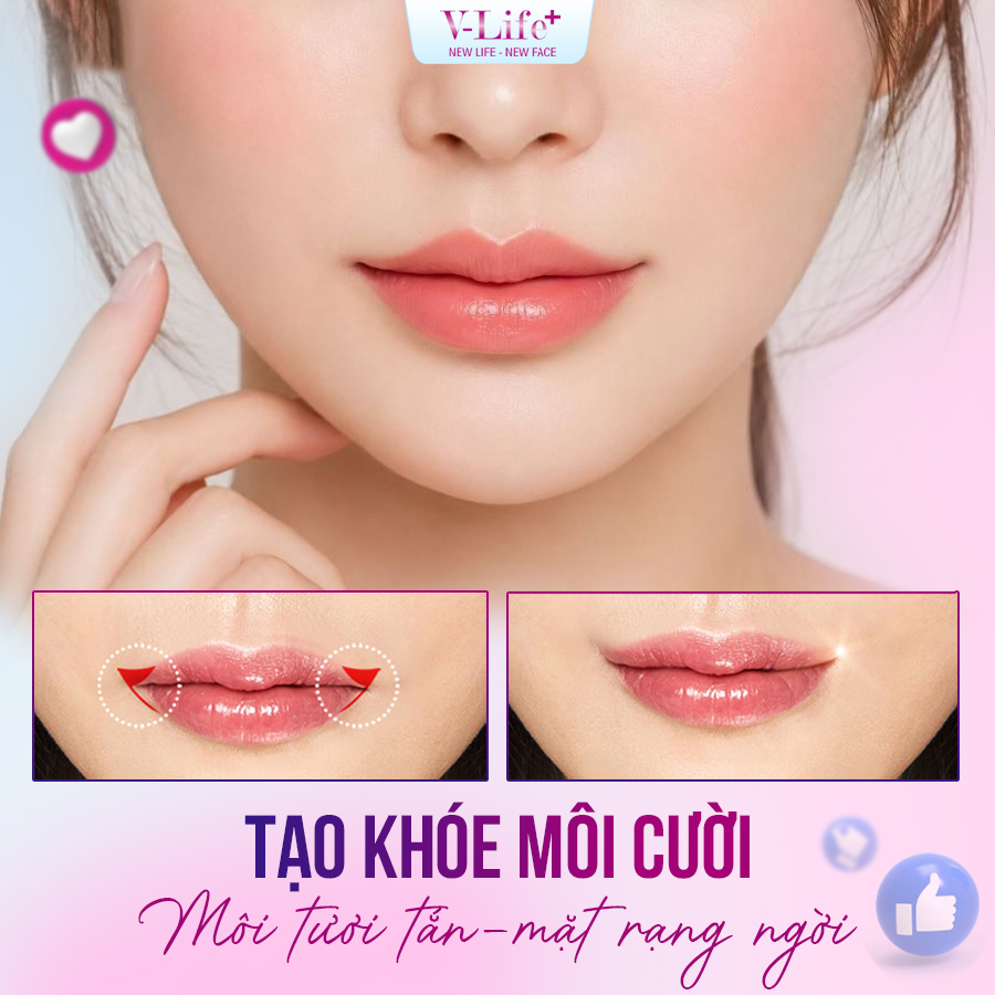 Môi cười