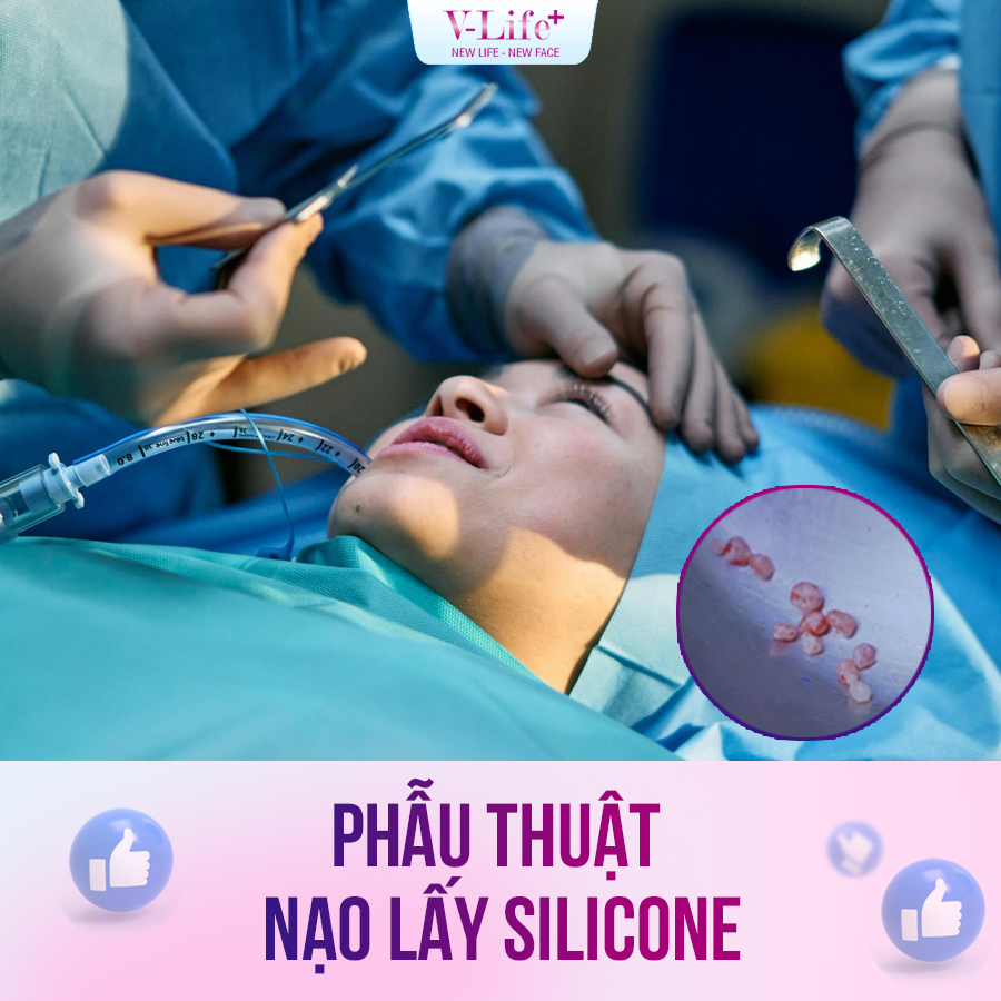 Mổ lấy Silicon