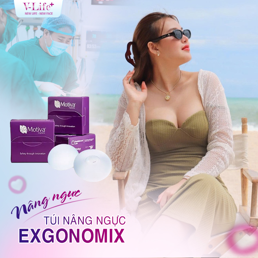Nâng ngực bằng túi Ergonomic