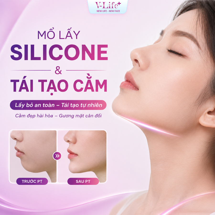 Mổ lấy Silicon và tái tạo cằm