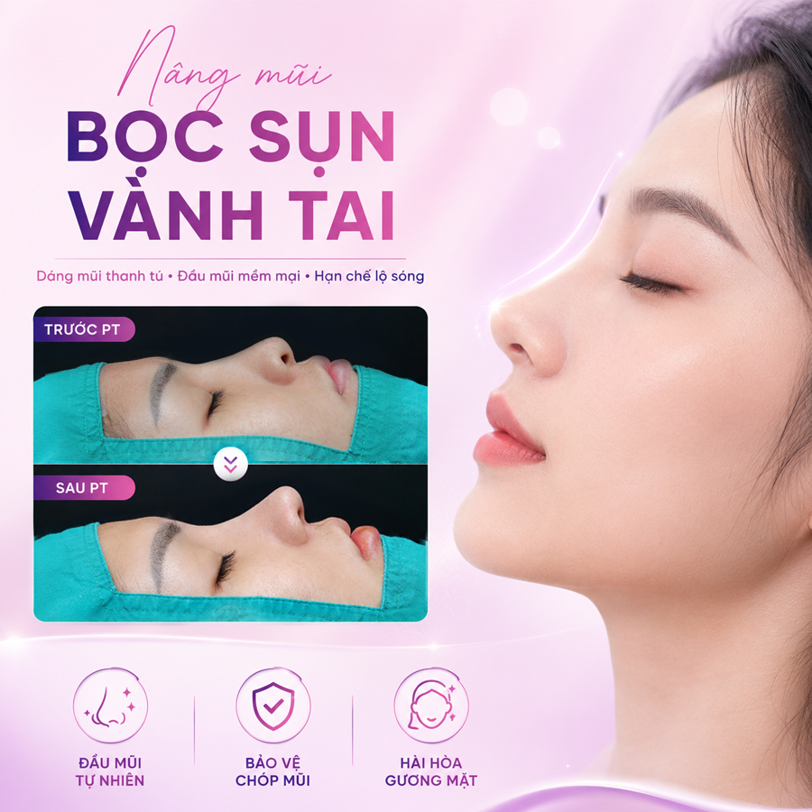 Nâng mũi bọc cân hoặc sụn vành tai