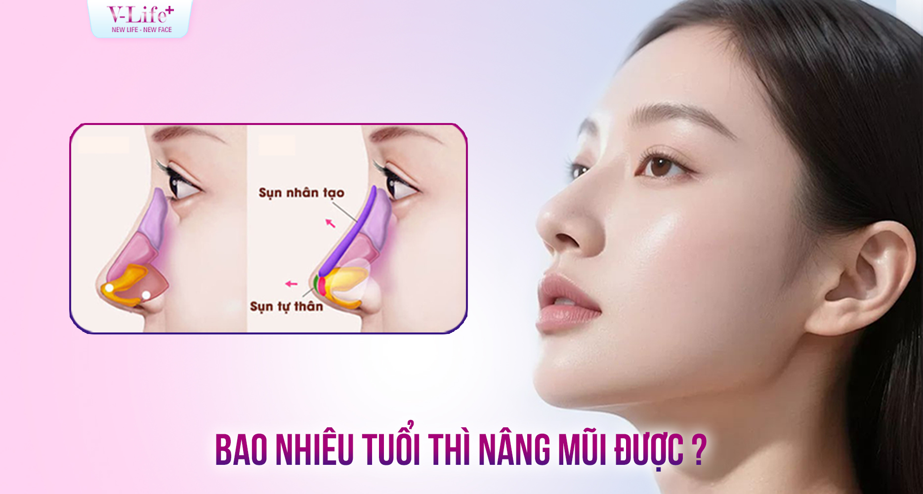 Bao nhiêu tuổi thì được nâng mũi? Độ tuổi nào phù hợp để phẫu thuật nâng mũi?