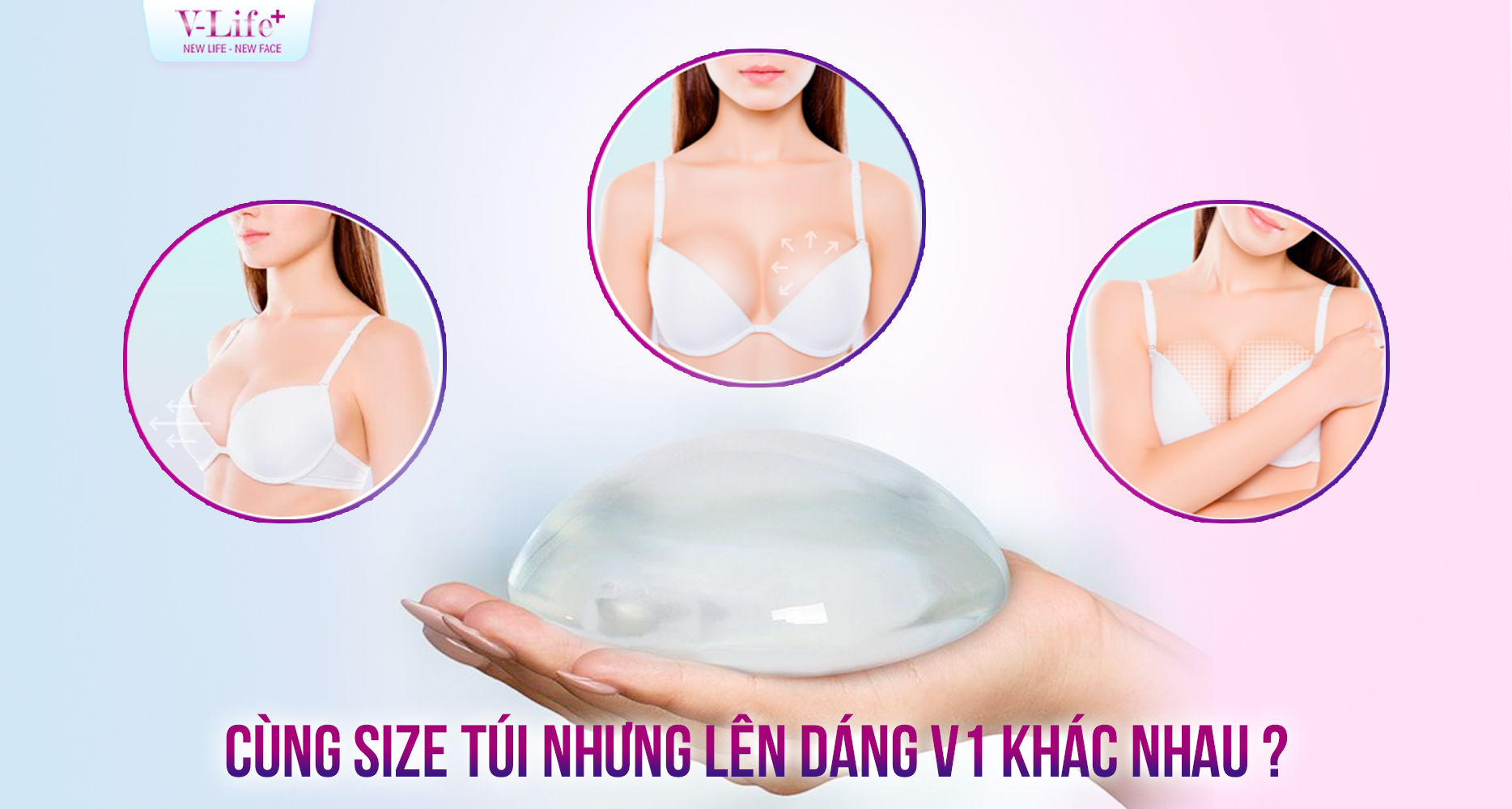 Cùng một size túi độn nhưng vì sao ngực mỗi người lên dáng khác nhau?