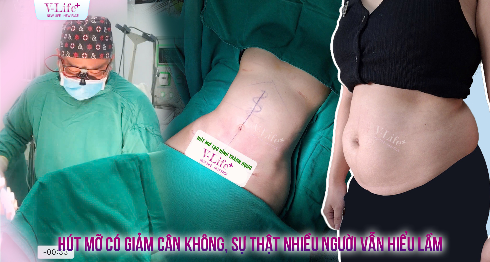 Hút Mỡ Có Thay Đổi Cân Nặng Nhiều Không? Sự Thật Nhiều Người Vẫn Hiểu Lầm